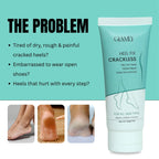 Heel Fix Cream For Cracked And Rough Feets