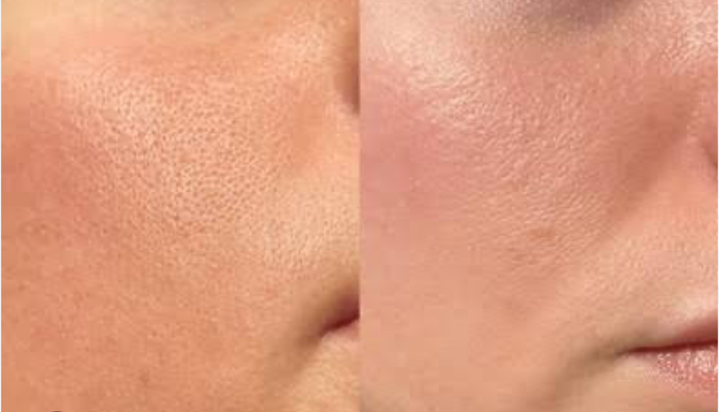 Glamly Brightening Cream
