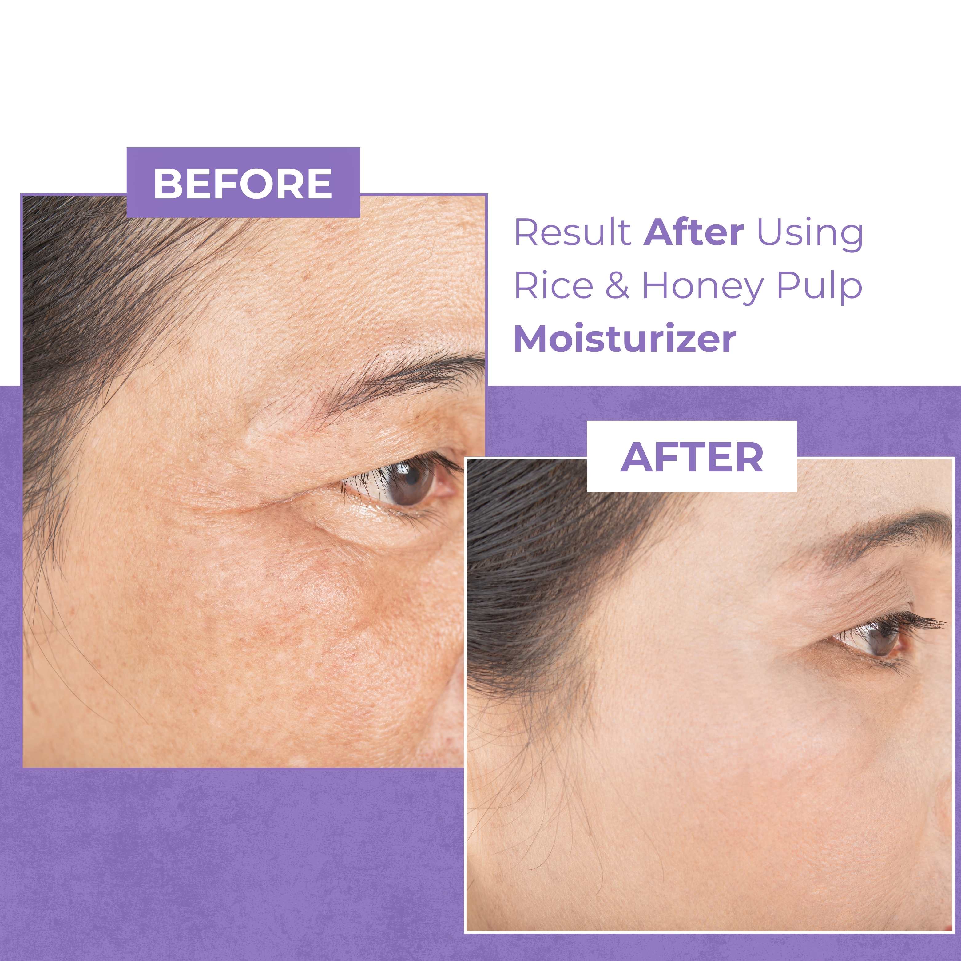 Rice and Honey Pulp Moisturizer