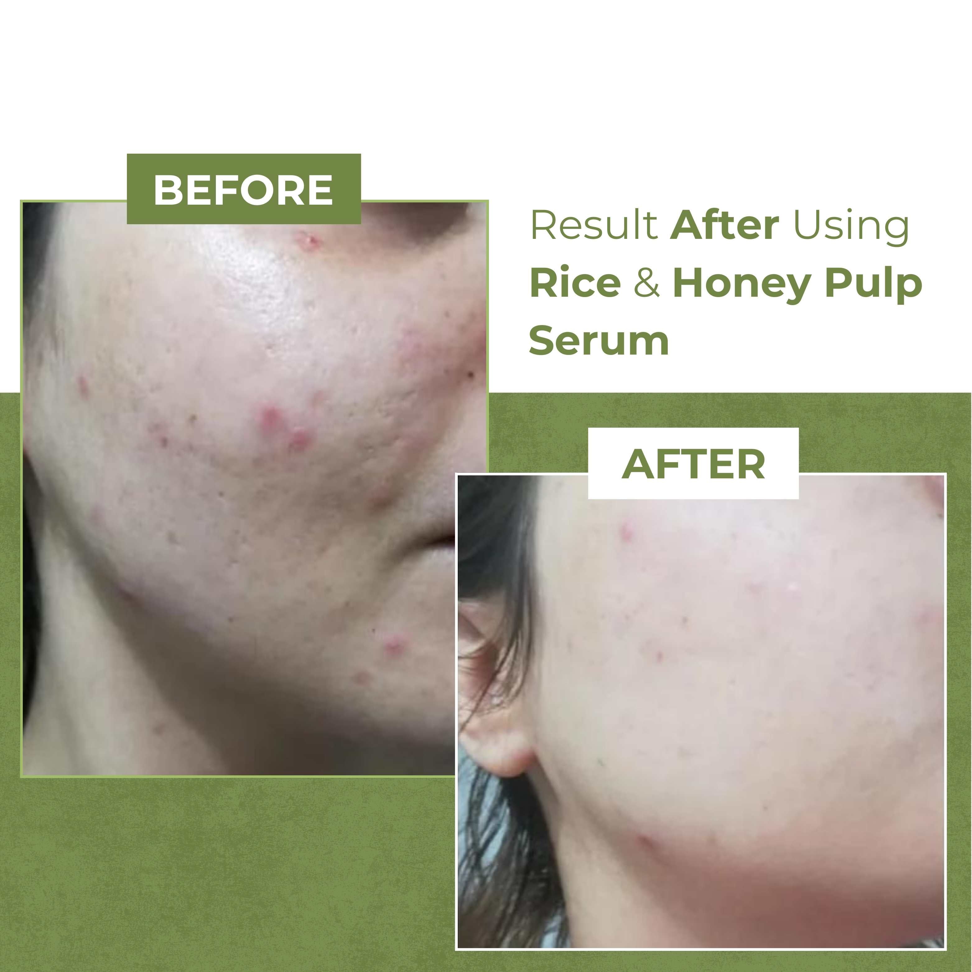 Glamly Rice and Honey Pulp Serum